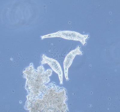 bdelloid rotifer Philodina roseola