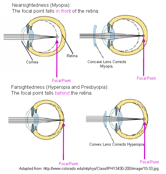 Preview for this node.