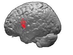 The left side of a human brain with the red area showing IFG. 