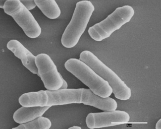 Microscopic view of a yeast culture by David Morgan