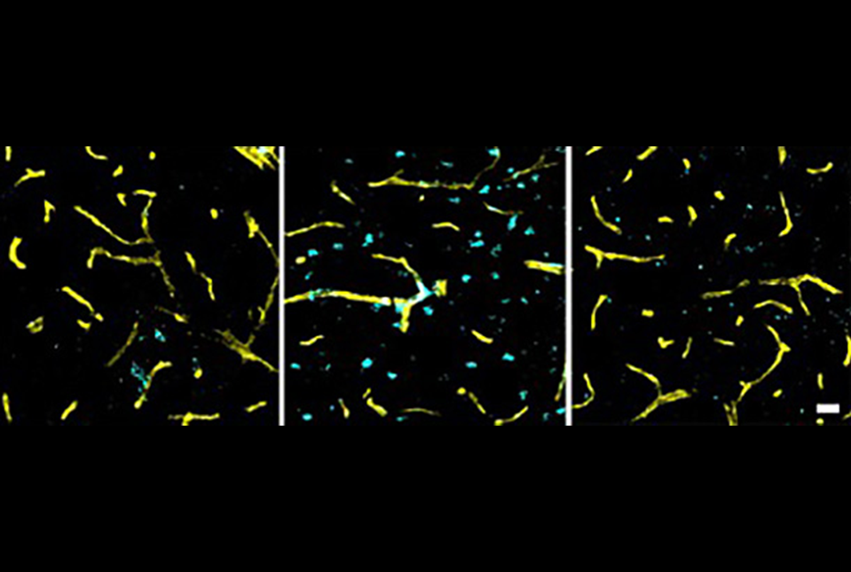 After Pre-Diabetes, Will CDC Call Pre-Hypertension A Pandemic Next?
