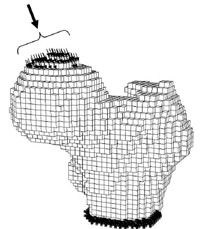 FEM model of femoral head in stance loading. Keyak, et al. FEM model of femoral head in stance loading. Keyak, et al.