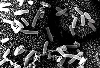 The Self-Assembling Armor Of The Clostridium Superbug