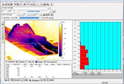  Isabel Fdez Corcobado, Institute of Legal Medicine of Granada, 2006. Software courtesy of Alava Ingenieros, S.A.