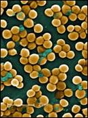 Preventing MRSA Through Positive Deviance