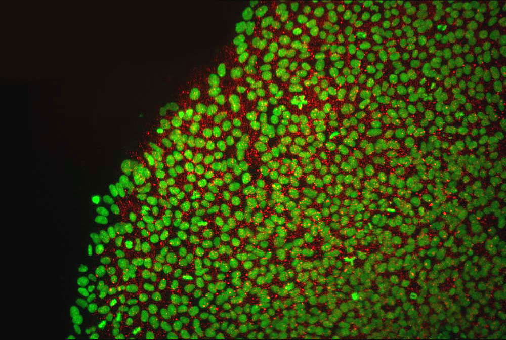 The Internal Debate Over Stem Cell Research Science 2.0