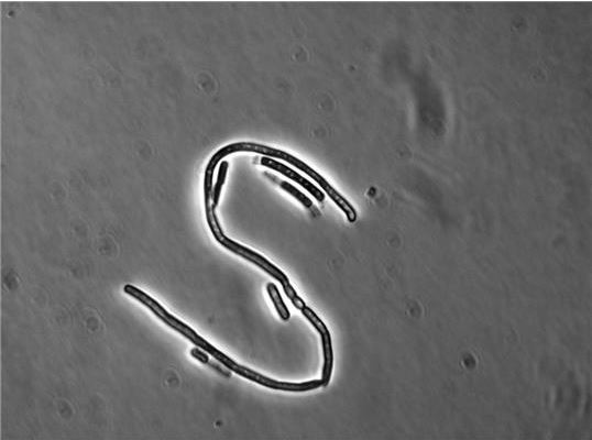 Bacillus Cereus Is Able To Resist Antibiotic Therapies