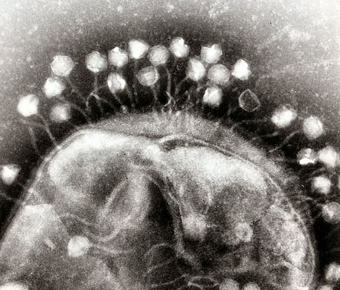 Designer Viruses Could Be The New Antibiotics