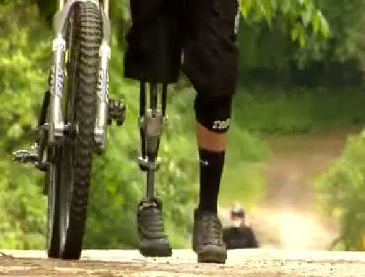 DIY Prosthetics: How An Athlete Who Wanted To Ski Again Built A New Kind Of Knee    