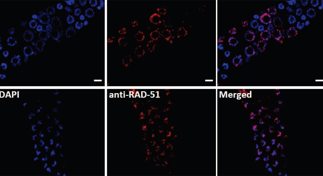 In Flies, NAD+ Supplements Slow Werner Syndrome Early Aging Syndrome