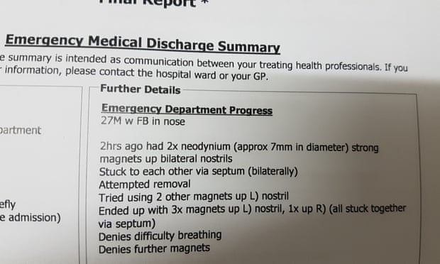 'At This Point I Ran Out of Magnets' - How Not To Get Things Stuck Up Your Nose