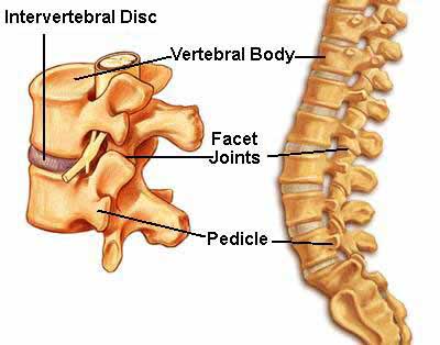 Ending Back Pain With Bio-Engineered Discs