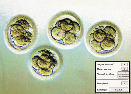 Octomom, Genetic Engineering And A Brave New World: The Ethics Of IVF