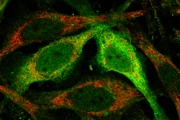 Antioxidant Supplements Are Not Science But CoQ In Mitochondria Is