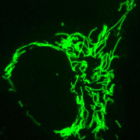 So Long Antibodies, Welcome Frankenbody