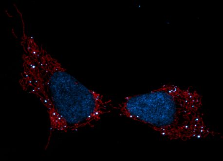 Mitochondria Send Out Cellular Distress Signals When DNA Are Damaged, Like In Chemotherapy