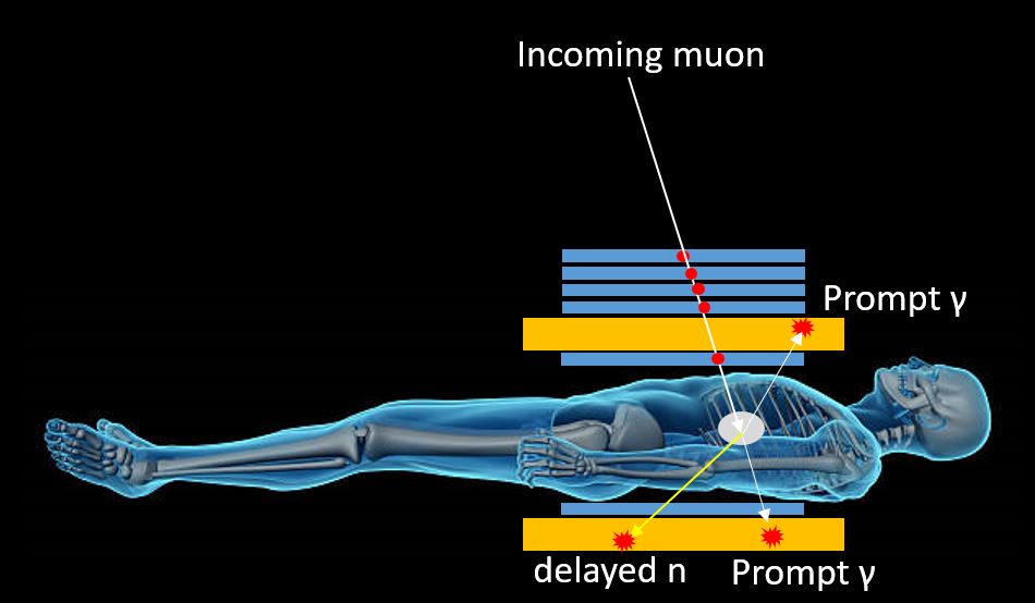 Imaging The Human Body With Muons