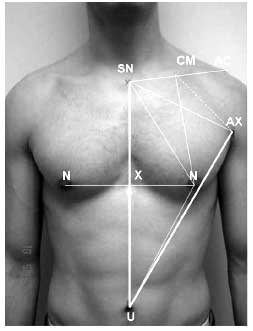 Male Nipple Repositioning And The Golden Ratio