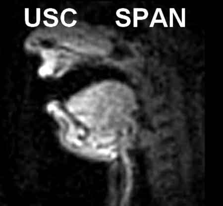 Sopranos - Under MRI