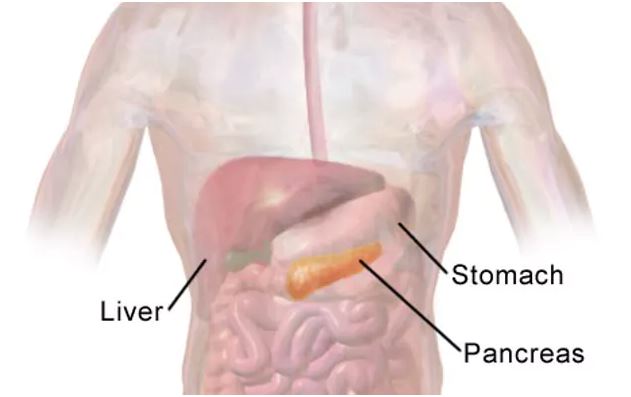 Pancreatic Cancer: Challenges And Treatment Advances
