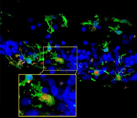 Immune System Slows Degenerative Eye Disease Retinitis Pigmentosa In Mice