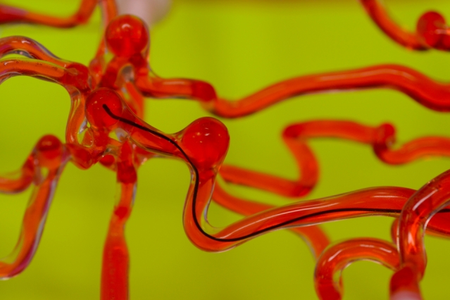 This Snake Crawls Through The Brain’s Blood Vessels - And That's A Good Thing