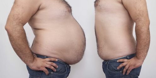 Science Of Losing Weight Shows It's Hard But Not Impossible