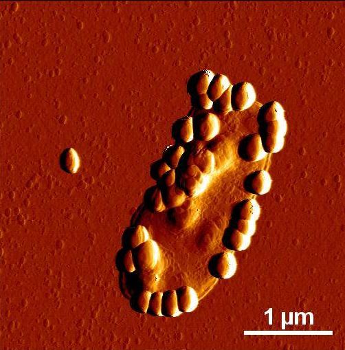 Defining Microbiome Deviancy Down: Now Even Nanoparticles Impact Your Gut?