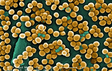 Resistant Staph Bacteria Has Met Its Match: Blue Light