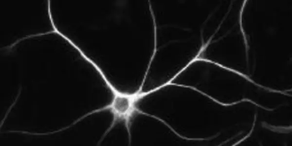 Could Niacin Be Added To Glioblastoma Treatment?
