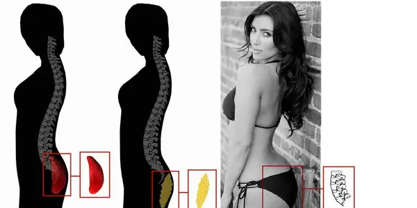 Kardashian Lumbar Curvature Index - An Evolutionary Hypothesis