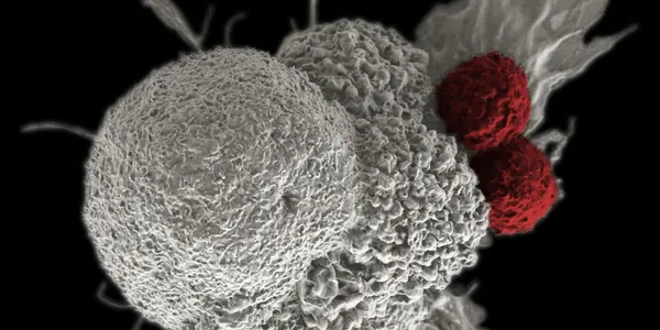 Genetically Edited White Blood Cells Are Already Helping Fight Cancer