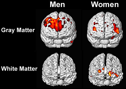 Sex On The Brain - How Men And Women Differ