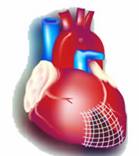 Engineering The Heart Piece By Piece