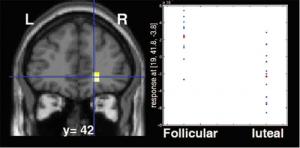 Brain's Reward Circuit Activity Ebbs And Flows With A Woman's Hormonal Cycle